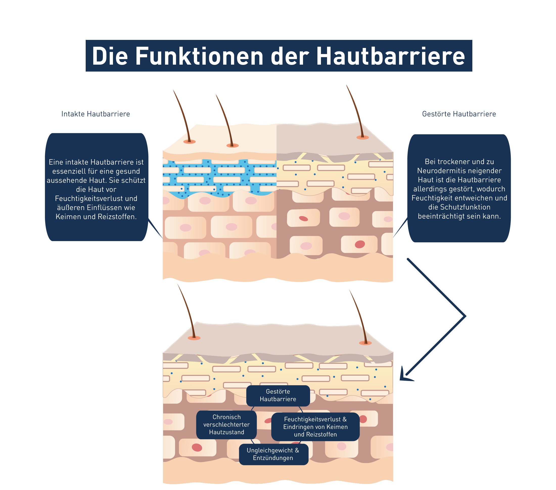 Trockene Haut am Körper: Visuelle Darstellung der Funktion der Hautbarriere